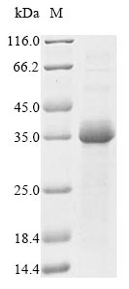 (Tris-Glycine gel) Discontinuous SDS-PAGE (reduced) with 5% enrichment gel and 15% separation gel.