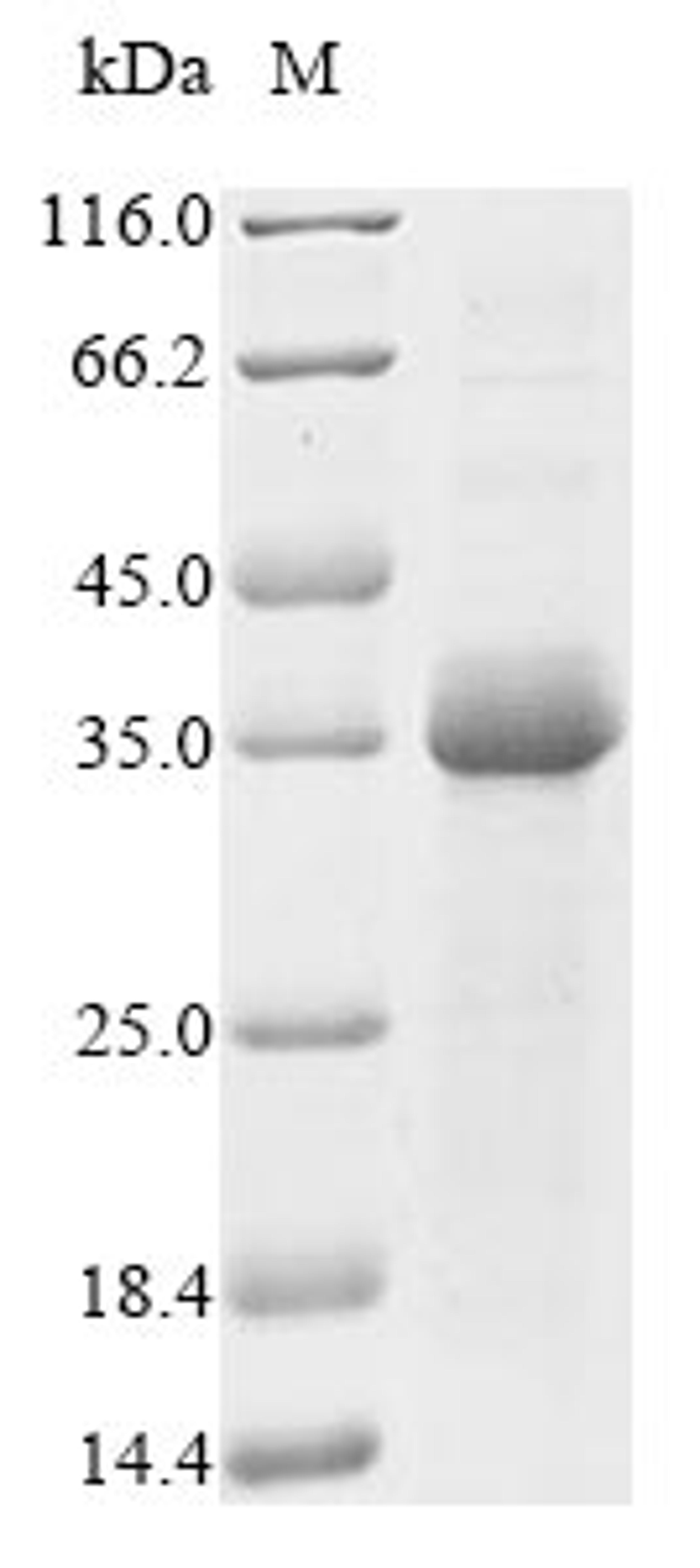 (Tris-Glycine gel) Discontinuous SDS-PAGE (reduced) with 5% enrichment gel and 15% separation gel.