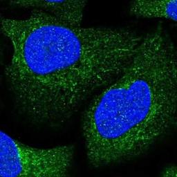 Immunocytochemistry: Aconitase 1 Antibody [NBP1-87677] - Staining of human cell line U-2 OS shows positivity in cytoplasm & mitochondria.