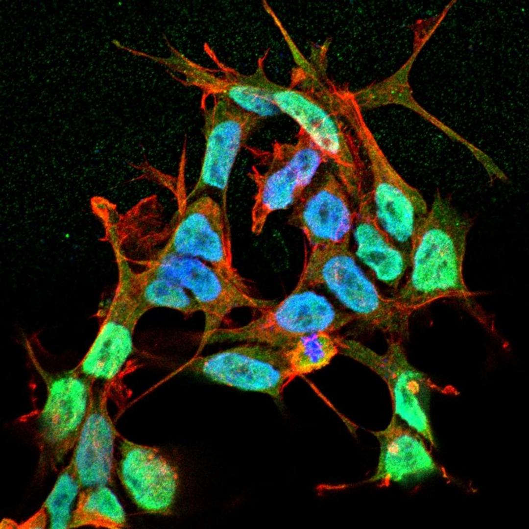 Immunofluorescence analysis of neuroblastoma cell line sk-n-be using NaVbeta3 antibody