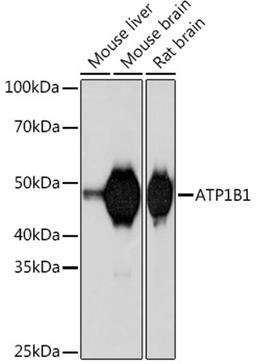 Western blot - ATP1B1 Rabbit mAb (A5113)