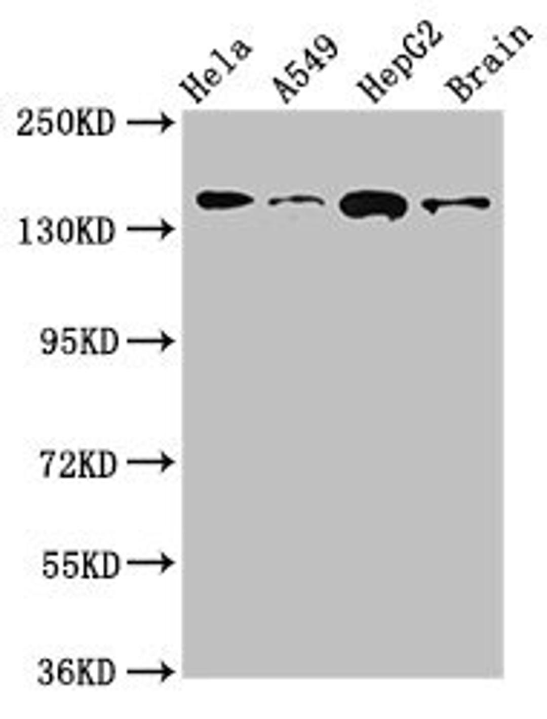 Western Blot. Positive WB detected in: Hela whole cell lysate, A549 whole cell lysate, HepG2 whole cell lysate, Mouse brain tissue. All lanes: ROCK2 antibody at 2.7ug/ml. Secondary. Goat polyclonal to rabbit IgG at 1/50000 dilution. Predicted band size: 161 kDa. Observed band size: 161 kDa. 