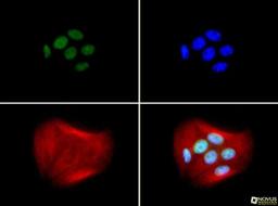 Immunocytochemistry/Immunofluorescence: BRCA1 Antibody (RAY) [NB100-598] - BRCA (RAY) antibody was tested in MCF-7 cells with FITC (green). Nuclei and alpha-tubulin were counterstained with Dapi (blue) and Dylight 550 (red).