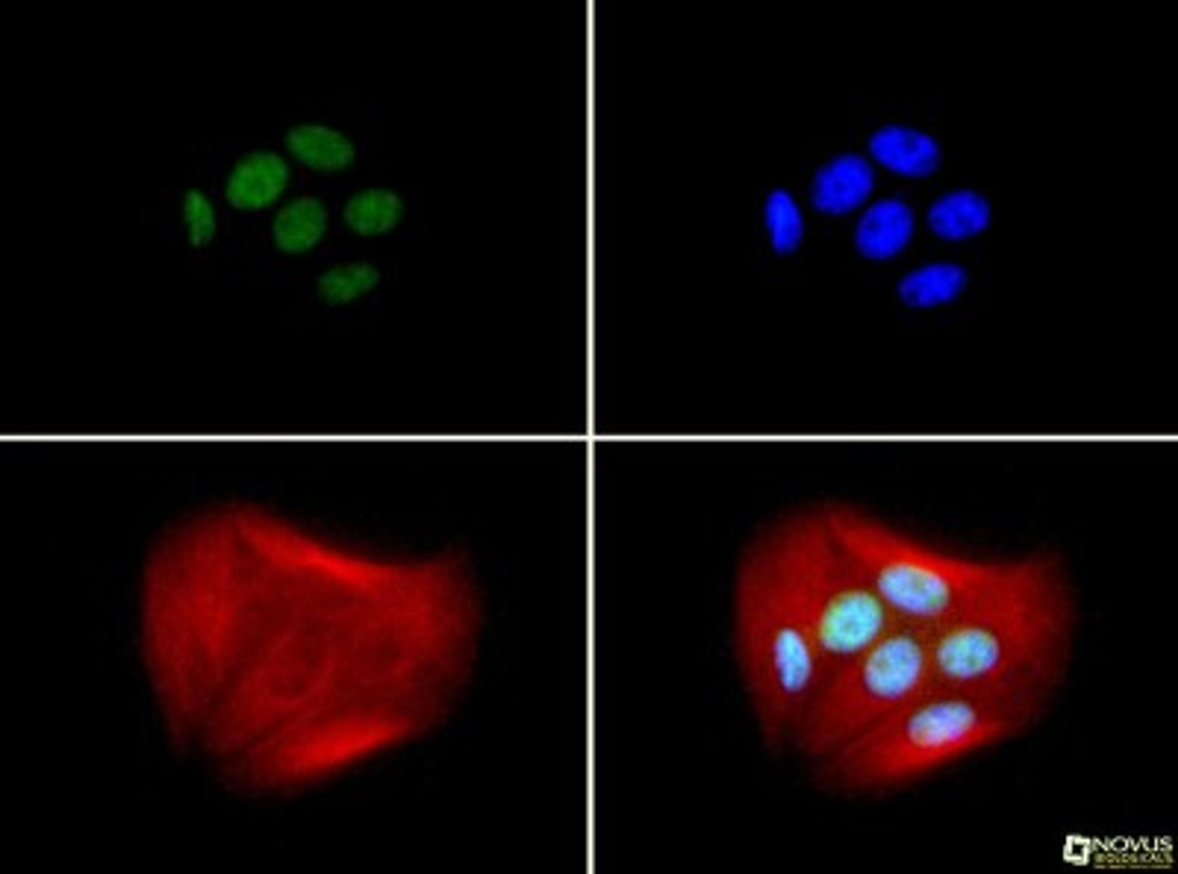 Immunocytochemistry/Immunofluorescence: BRCA1 Antibody (RAY) [NB100-598] - BRCA (RAY) antibody was tested in MCF-7 cells with FITC (green). Nuclei and alpha-tubulin were counterstained with Dapi (blue) and Dylight 550 (red).