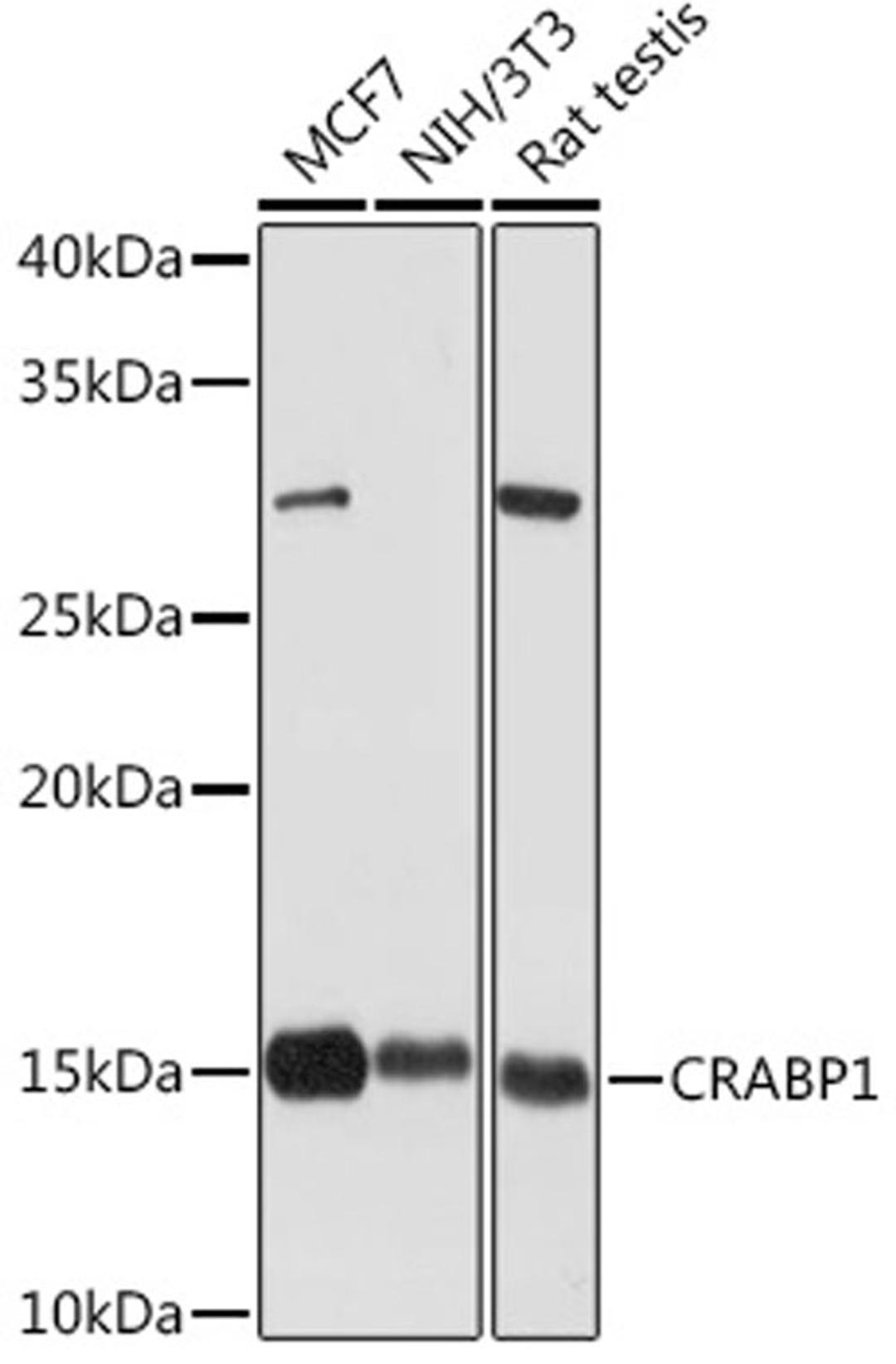 Western blot - CRABP1 Rabbit mAb (A5434)