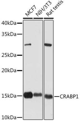 Western blot - CRABP1 Rabbit mAb (A5434)