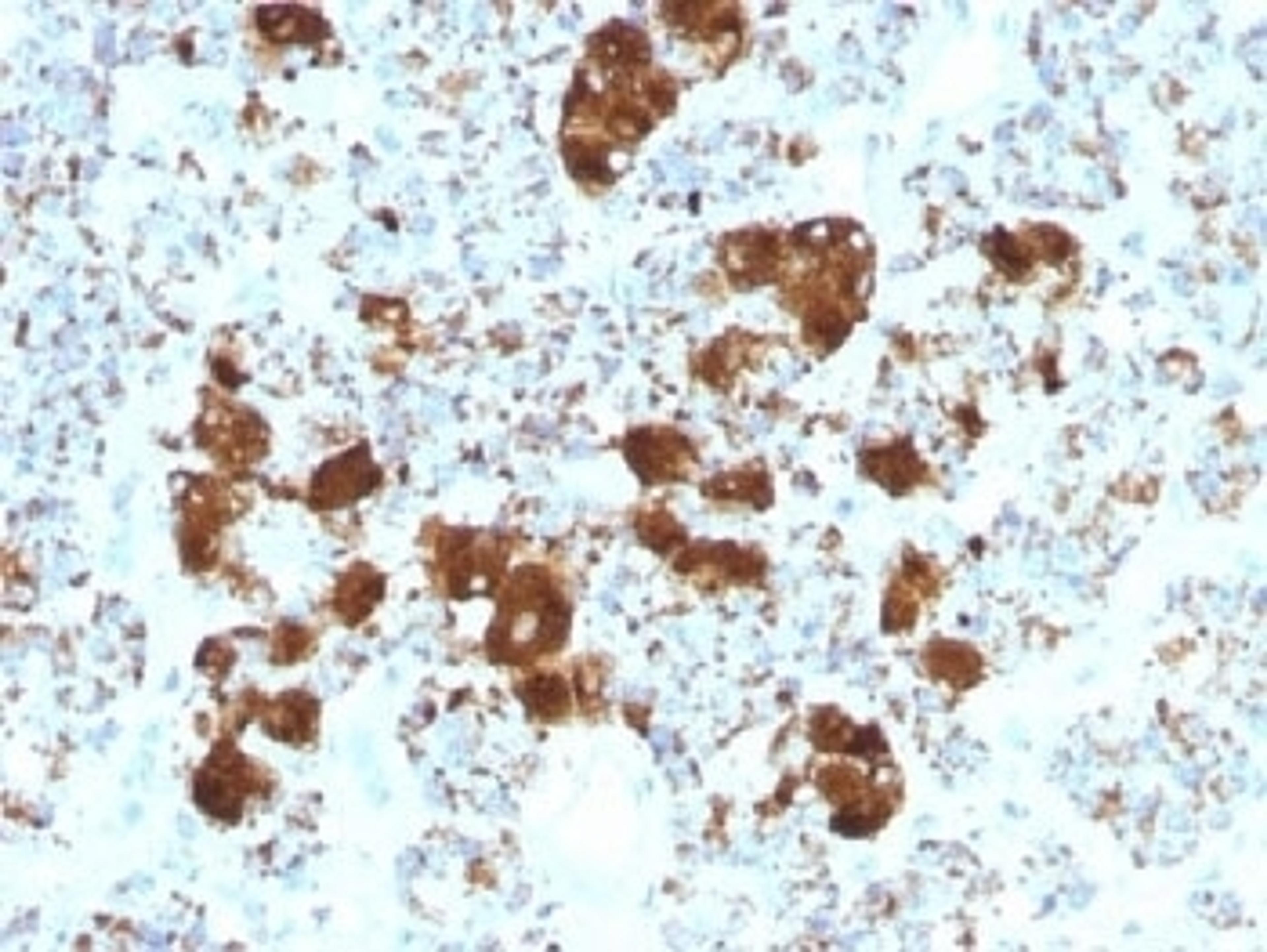 IHC testing of FFPE human pituitary gland with ACTH antibody (clone SPM501). Required HIER: steam sections in 10mM citrate buffer, pH6, for 10-20 min.