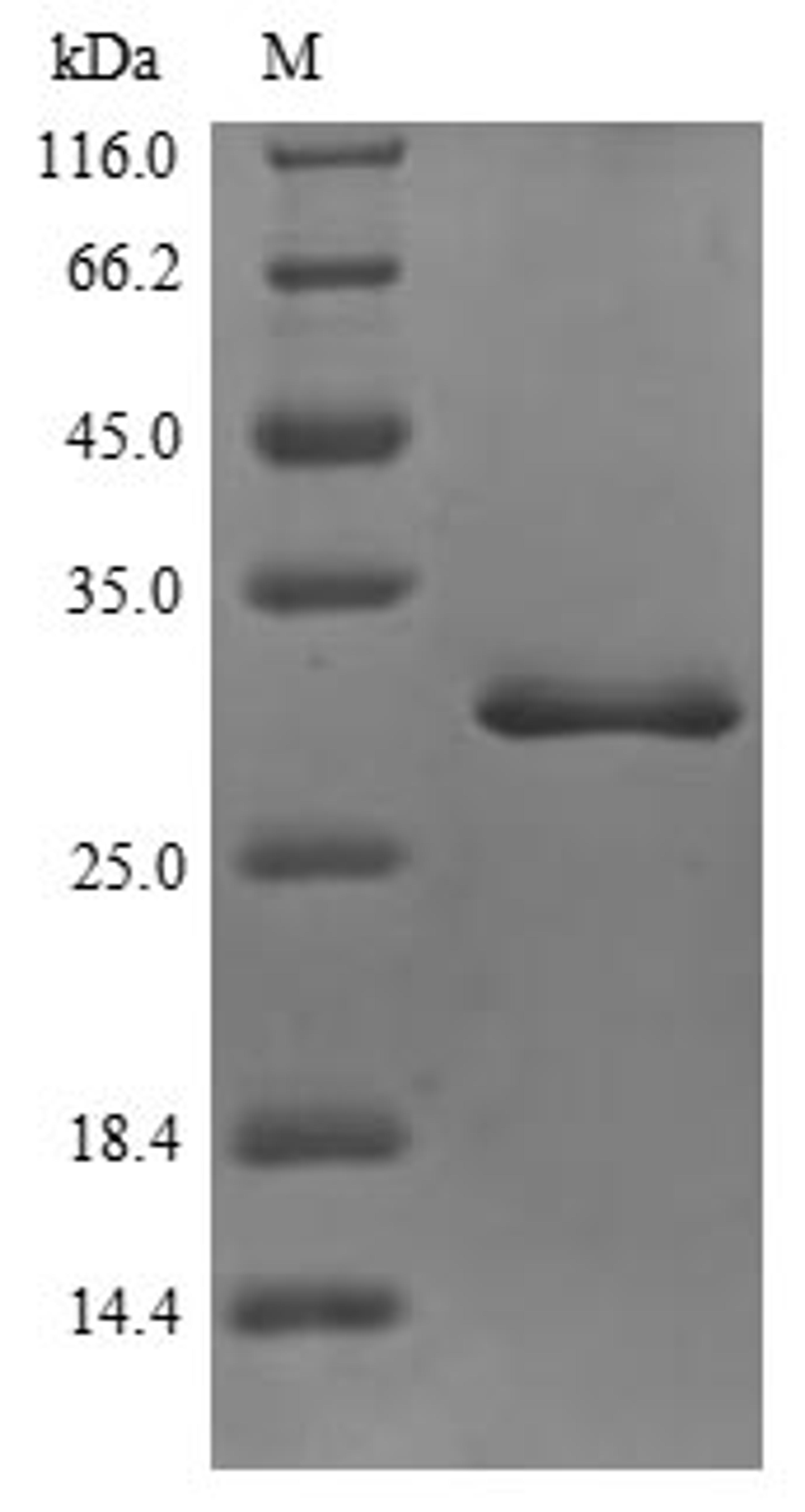 (Tris-Glycine gel) Discontinuous SDS-PAGE (reduced) with 5% enrichment gel and 15% separation gel.