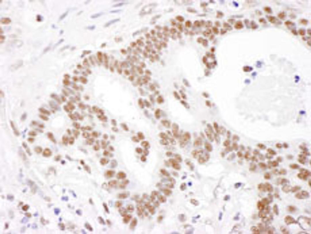 Detection of human PABPN1 by immunohistochemistry.