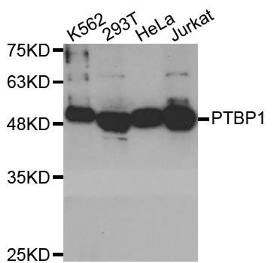 Western blot analysis of extracts of various cell lines using PTBP1 antibody