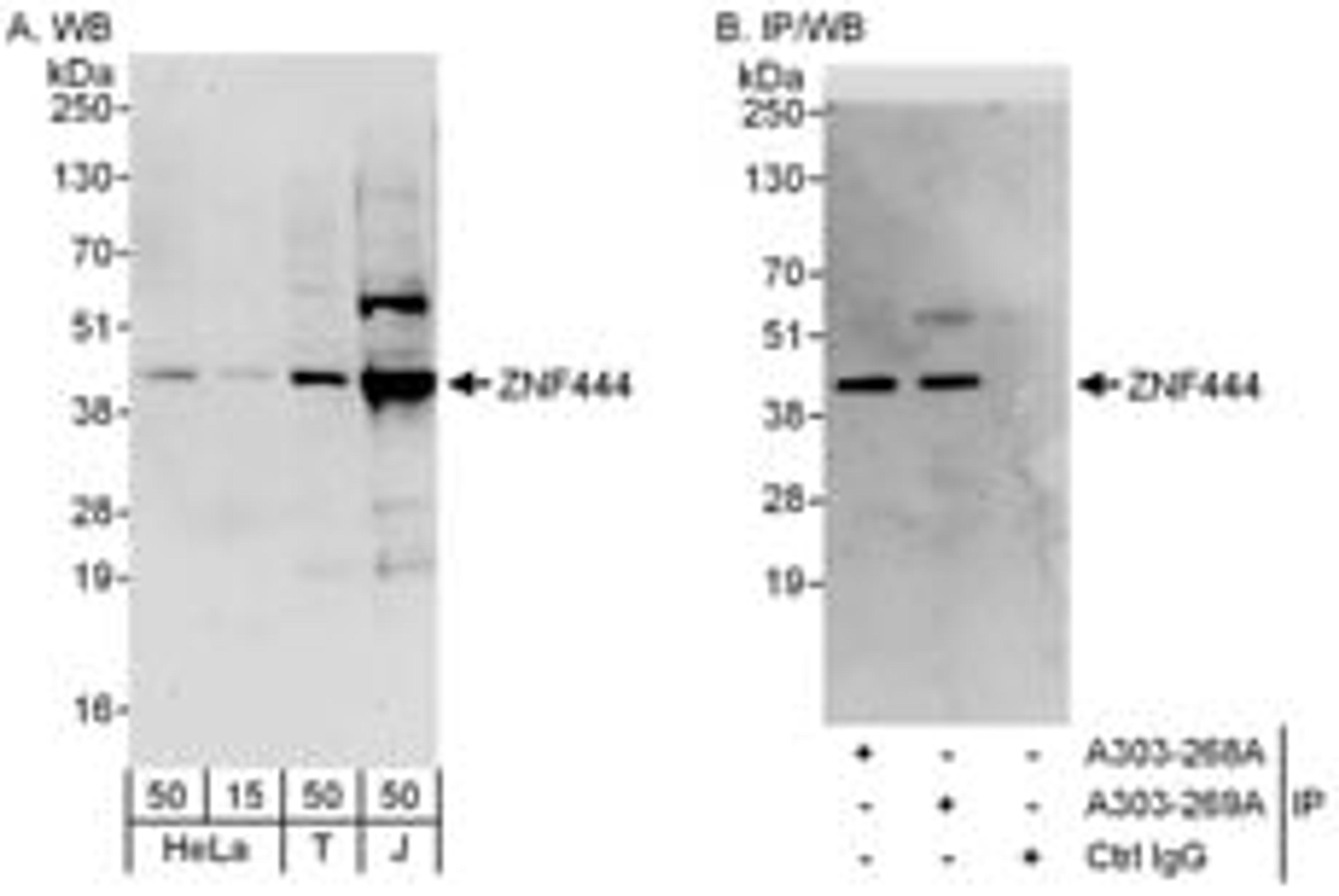 Detection of human ZNF444 by western blot and immunoprecipitation.