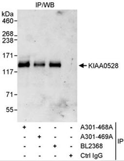 Detection of human KIAA0528 by western blot of immunoprecipitates.