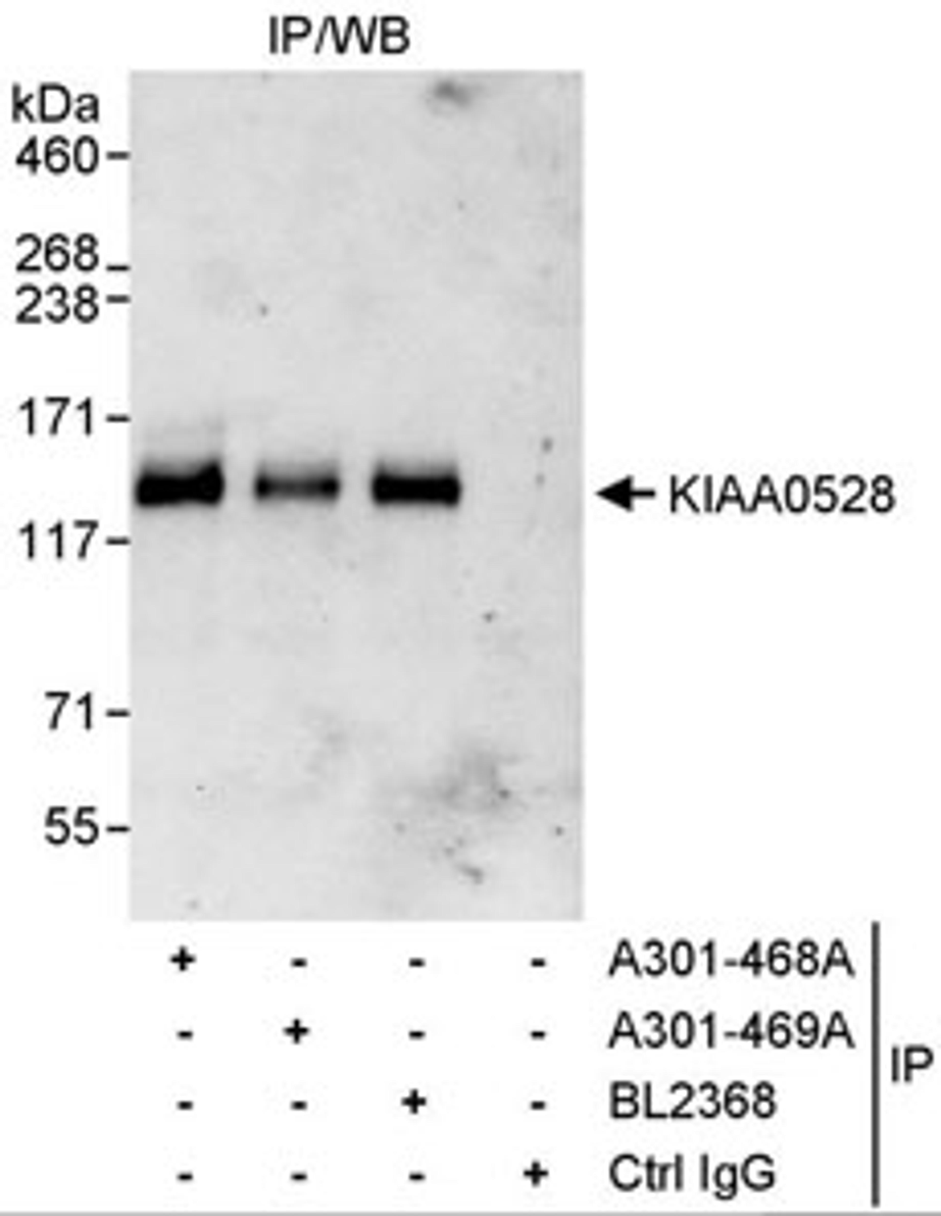 Detection of human KIAA0528 by western blot of immunoprecipitates.