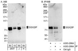 Detection of human SSX2IP by western blot and immunoprecipitation.