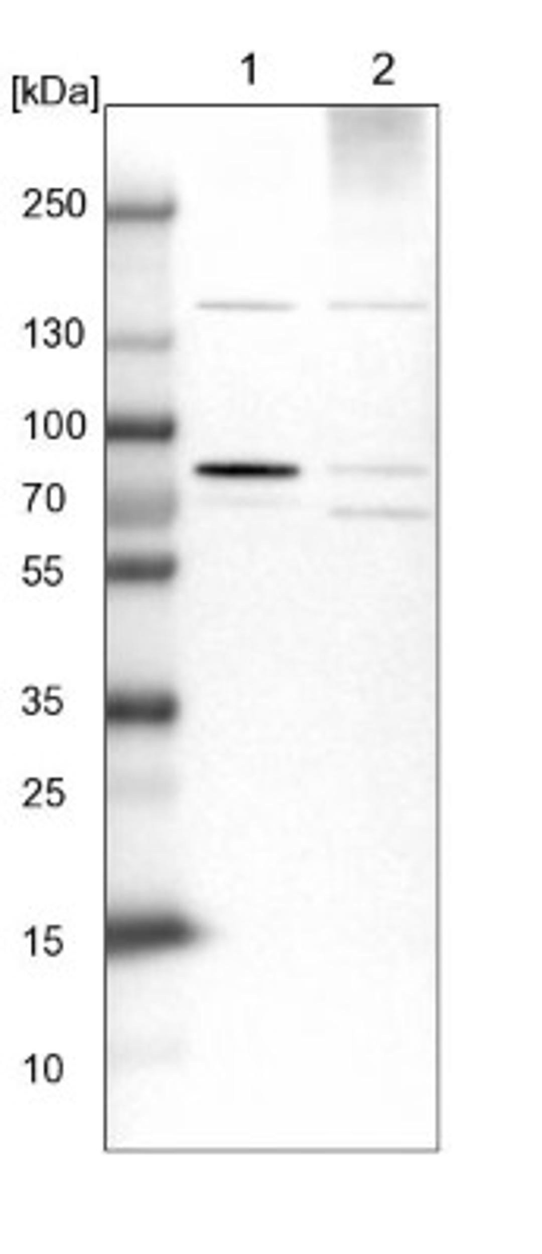 Western Blot: HBS1L Antibody [NBP1-85123] - Lane 1: NIH-3T3 cell lysate (Mouse embryonic fibroblast cells)<br/>Lane 2: NBT-II cell lysate (Rat Wistar bladder tumour cells)