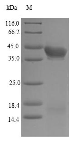 (Tris-Glycine gel) Discontinuous SDS-PAGE (reduced) with 5% enrichment gel and 15% separation gel.