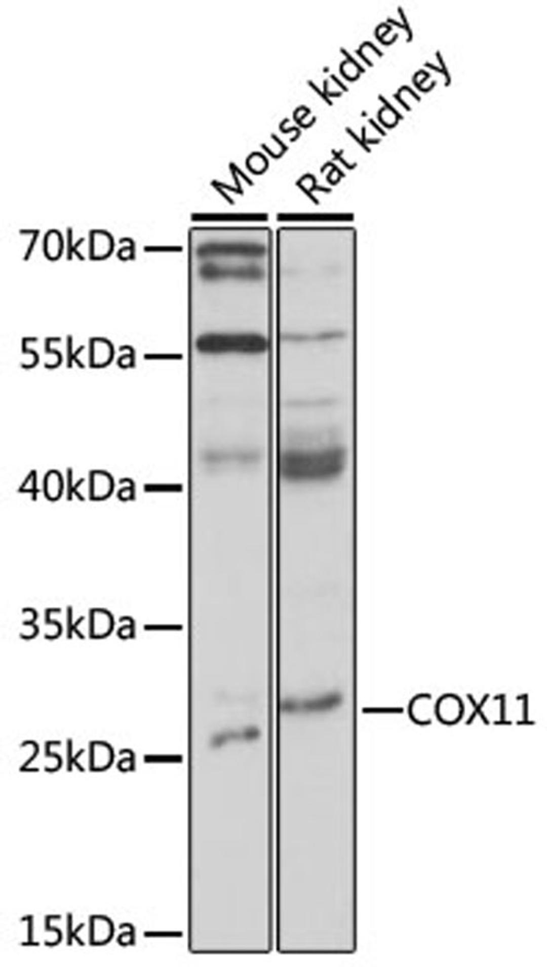 Western blot - COX11 antibody (A16290)