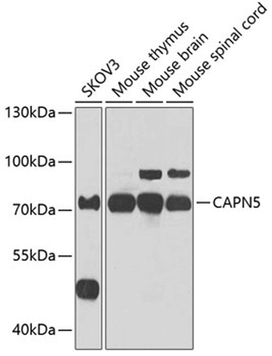 Western blot - CAPN5 antibody (A7428)