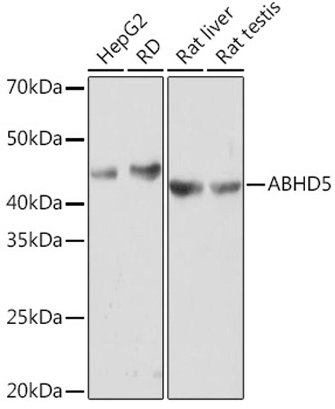 Western blot - ABHD5 Rabbit mAb (A8673)