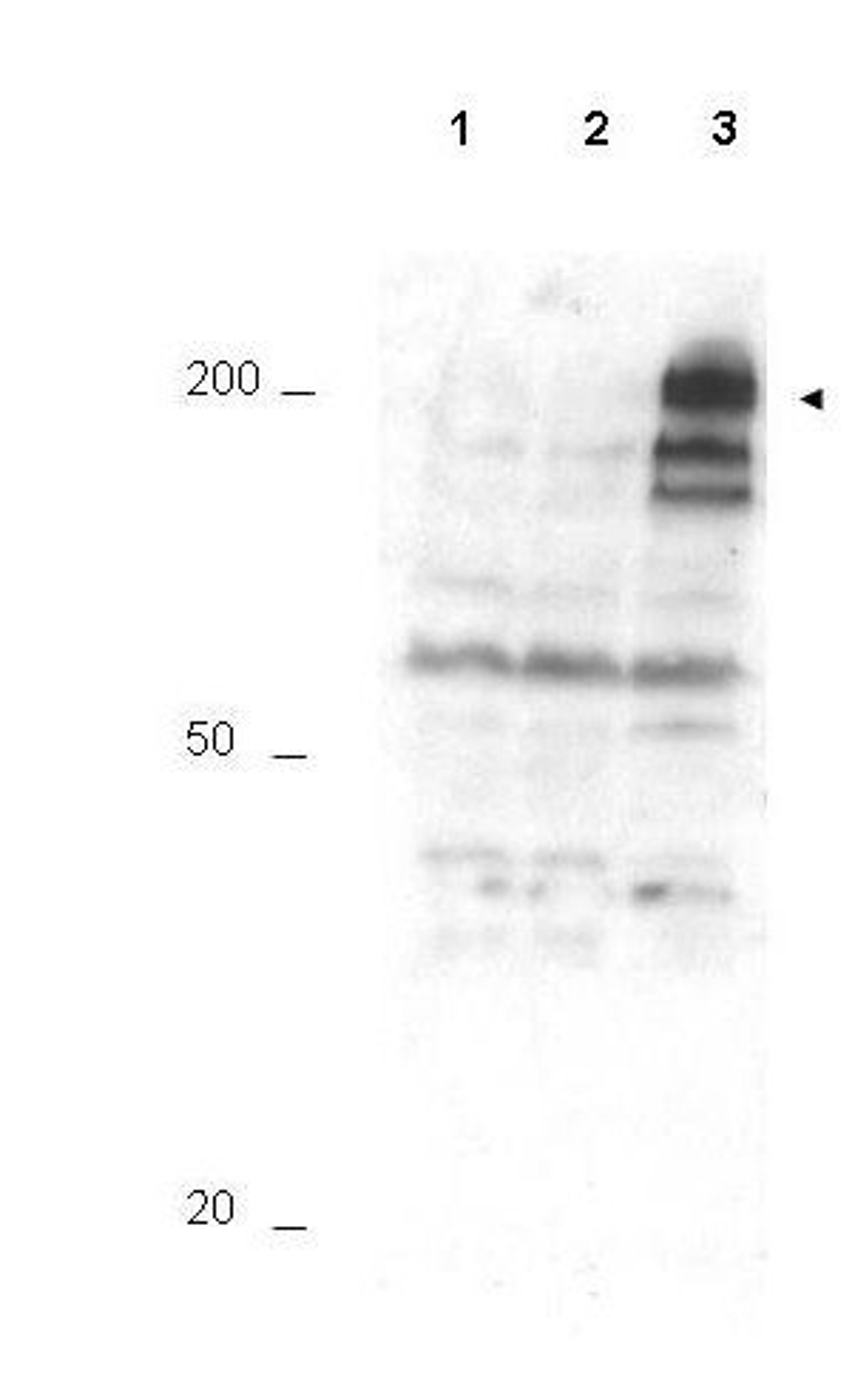 Western blot analysis of shows lysate from asynchronous cells (Lane1), shows lysate from cells treated with thymidine to synchronize cells at the G1/S boundary (Lane2), shows lysate from cells treated with nocodazole to synchronize cells at the M phase (L