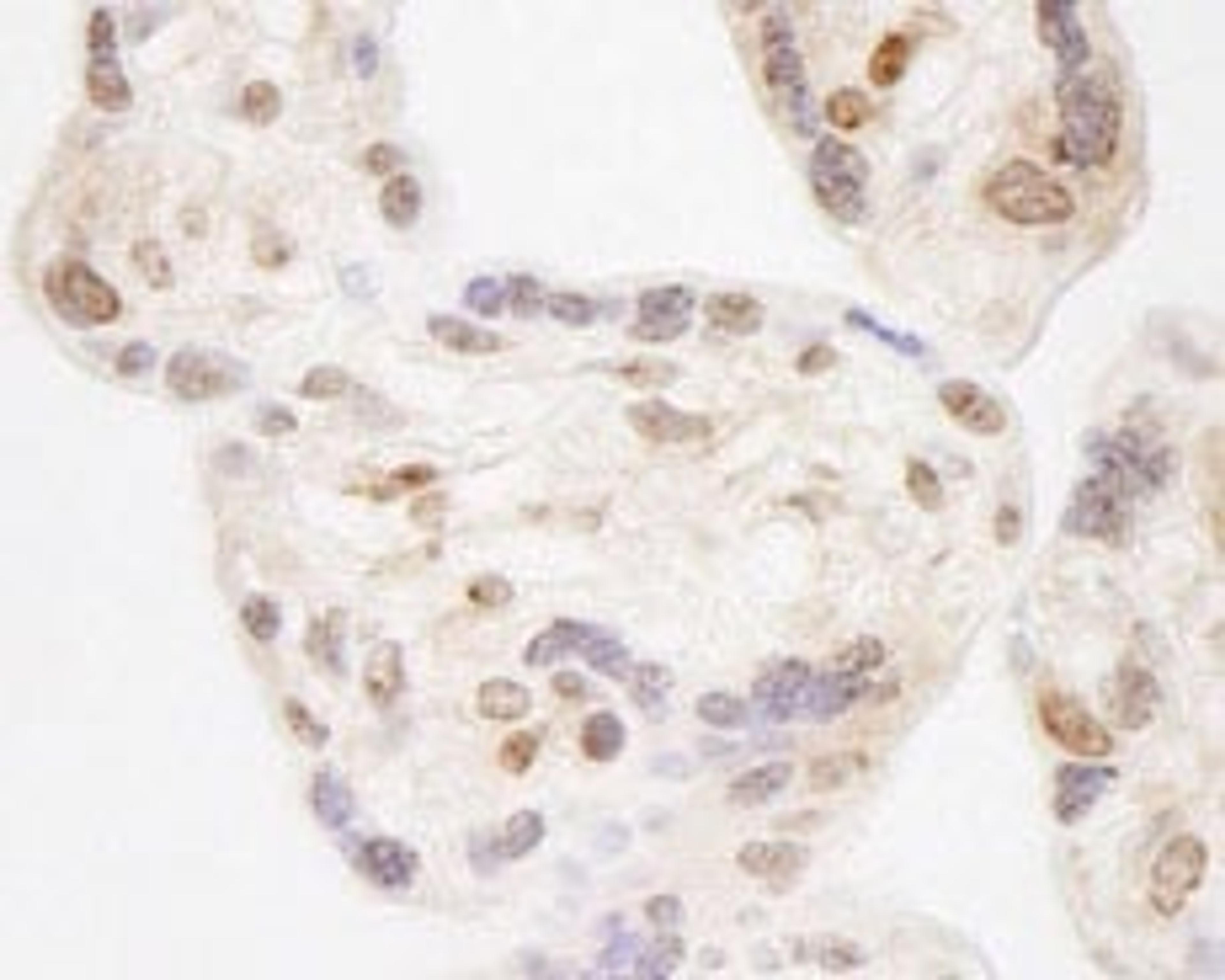 Detection of human NELFA by immunohistochemistry.