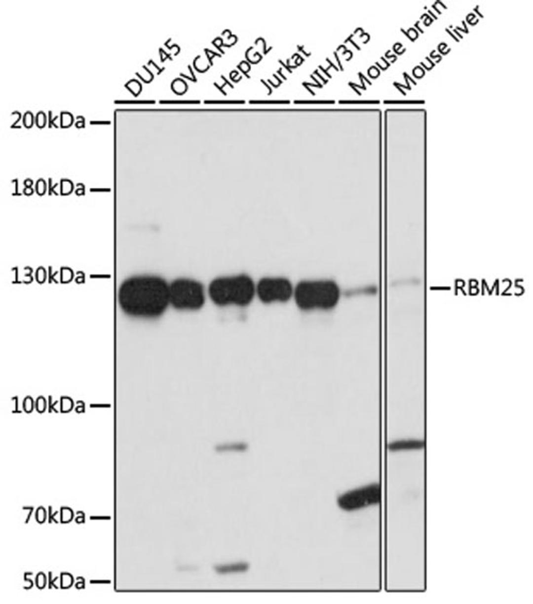 Western blot - RBM25 antibody (A15496)