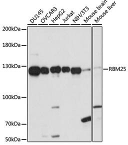 Western blot - RBM25 antibody (A15496)