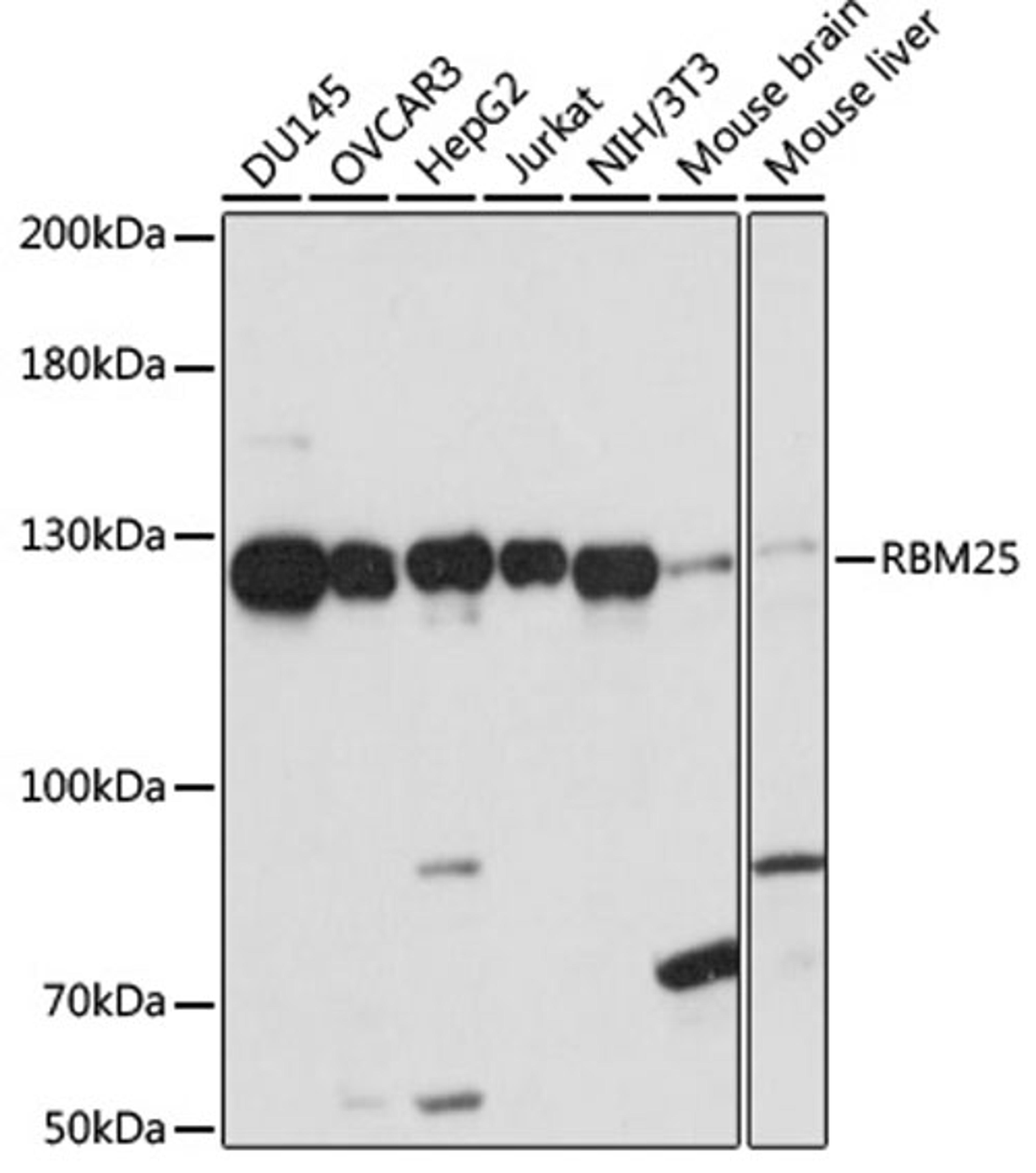 Western blot - RBM25 antibody (A15496)