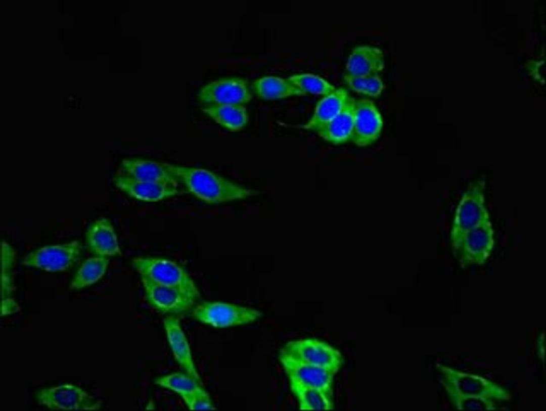 Immunofluorescence analysis of HepG2 cells using TIGIT antibody