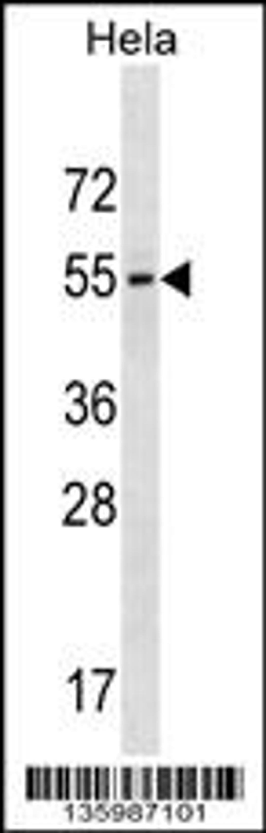 Western blot analysis in Hela cell line lysates (35ug/lane).