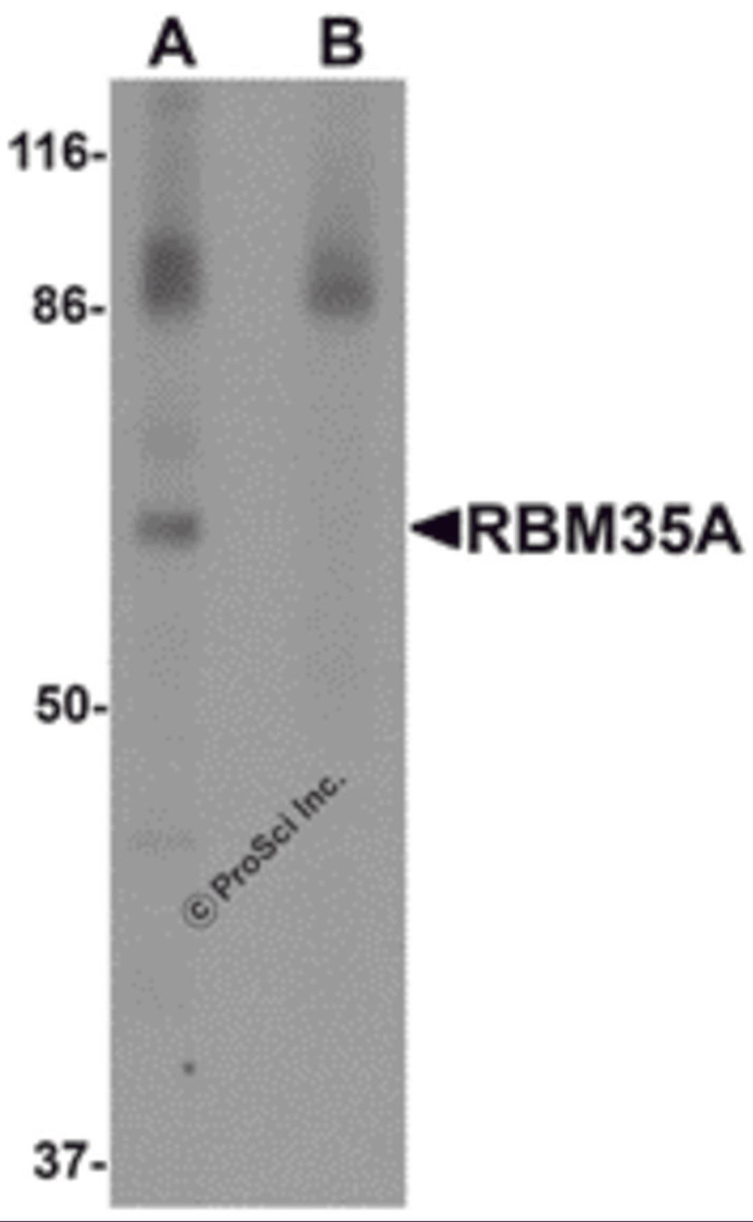 Western blot analysis of RBM35A in rat colon tissue lysate with RBM35A antibody at 0.5 &#956;g/mL in (A) the absence and (B) the presence of blocking peptide.