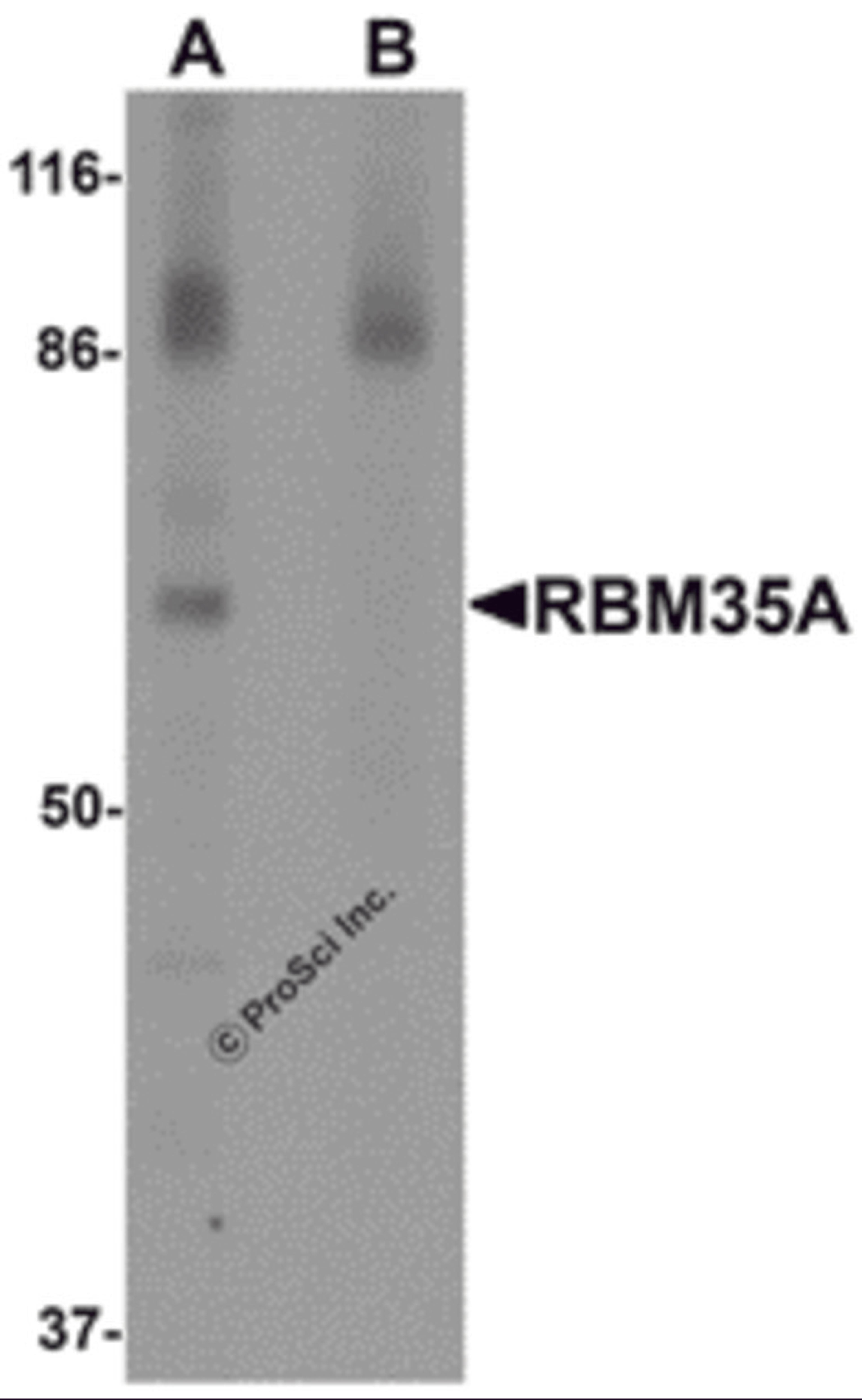 Western blot analysis of RBM35A in rat colon tissue lysate with RBM35A antibody at 0.5 &#956;g/mL in (A) the absence and (B) the presence of blocking peptide.