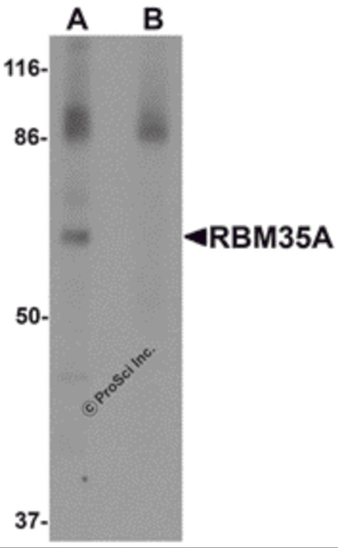 Western blot analysis of RBM35A in rat colon tissue lysate with RBM35A antibody at 0.5 μg/mL in (A) the absence and (B) the presence of blocking peptide.