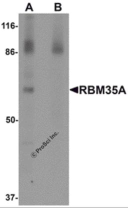 Western blot analysis of RBM35A in rat colon tissue lysate with RBM35A antibody at 0.5 μg/mL in (A) the absence and (B) the presence of blocking peptide.