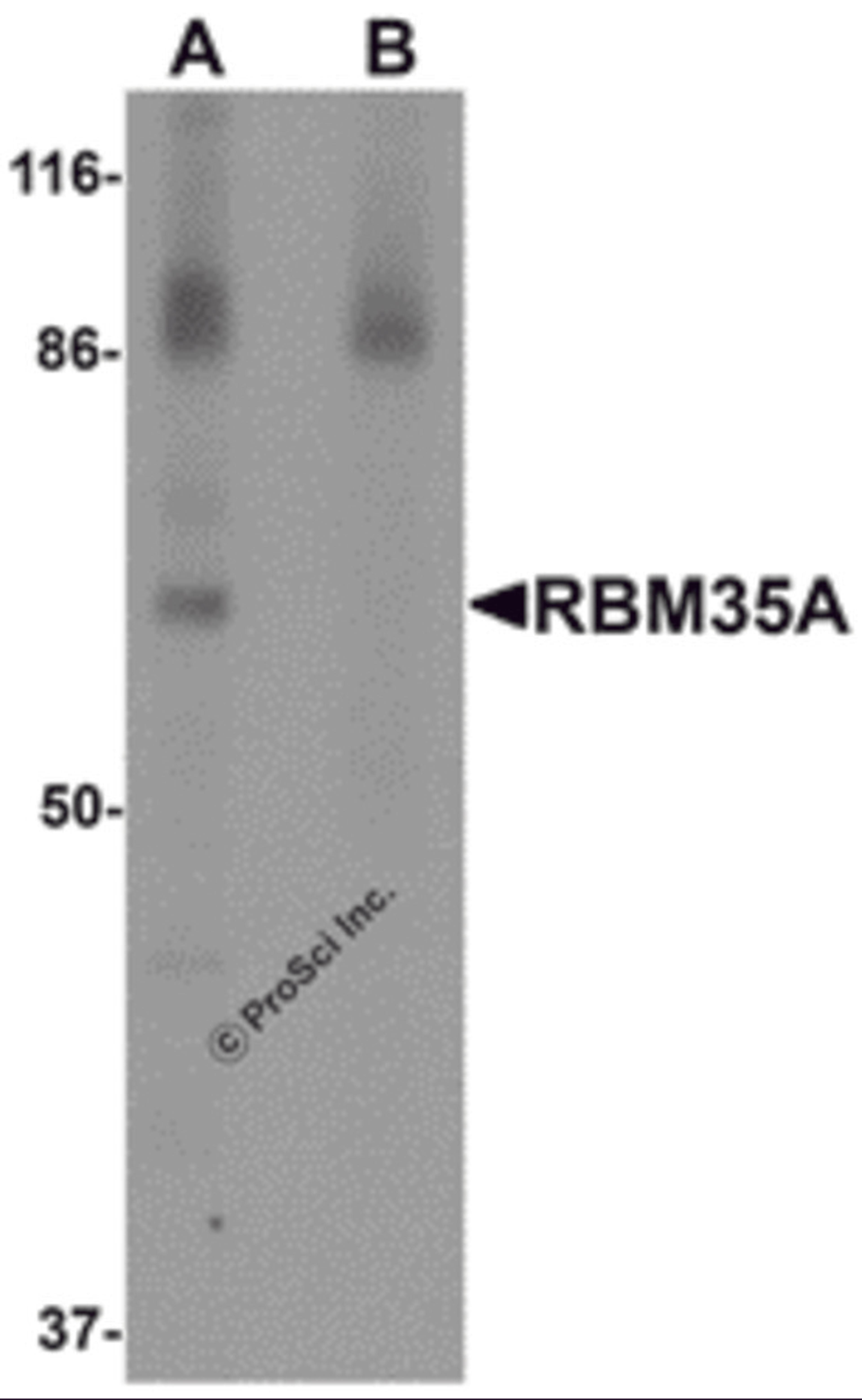 Western blot analysis of RBM35A in rat colon tissue lysate with RBM35A antibody at 0.5 μg/mL in (A) the absence and (B) the presence of blocking peptide.