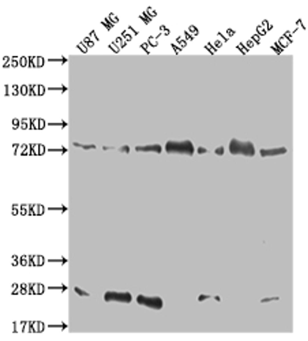 Western Blot. Positive WB detected in: U87 whole cell lysate, U251 whole cell lysate, PC3 whole cell lysate, A549 whole cell lysate, Hela whole cell lysate, HepG2 whole cell lysate, MCF-7 whole cell lysate. All lanes: CAPN2 antibody at 1:500. Secondary. Goat polyclonal to rabbit IgG at 1/50000 dilution. Predicted band size: 80, 72 kDa. Observed band size: 72-95 kDa. 