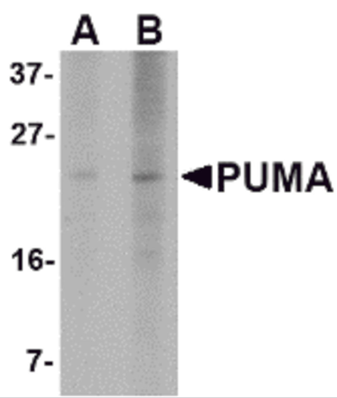 Western blot analysis of PUMA expression in K562 cell lysate with PUMA antibody at (A) 2.5 and (B) 5 μg/mL.