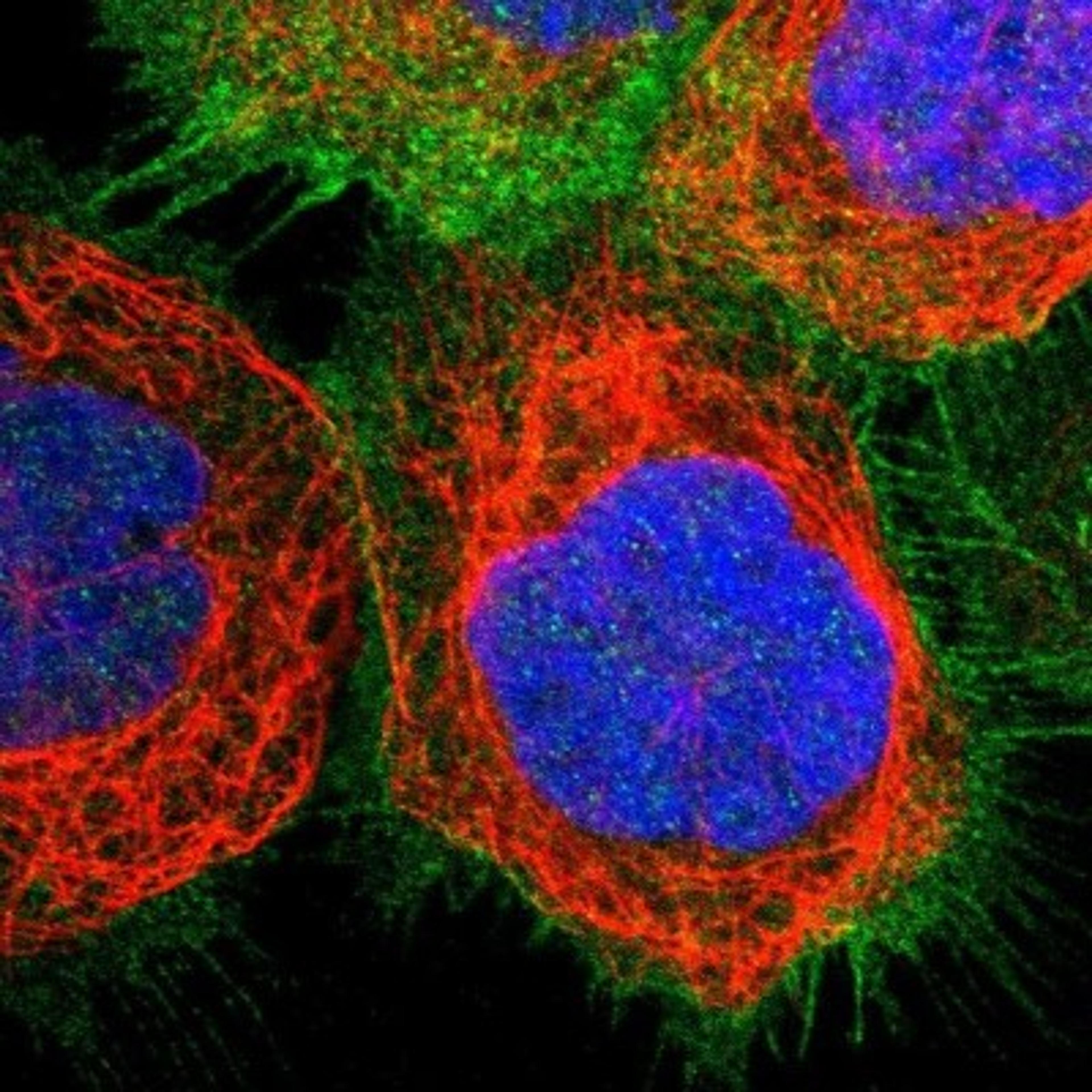 Immunocytochemistry/Immunofluorescence: Myosin 1B Antibody [NBP1-87739] - Staining of human cell line A-431 shows positivity in plasma membrane & cell junctions.