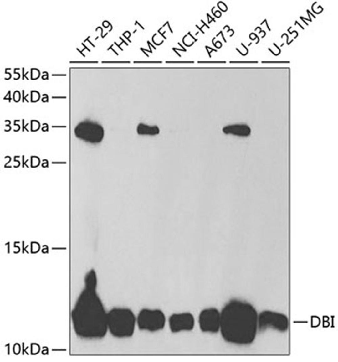 Western blot - DBI antibody (A5370)