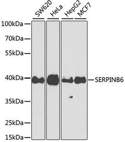 Western blot - SERPINB6 antibody (A9944)