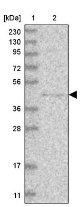 Western Blot: PCMTD1 Antibody [NBP1-83817] - Lane 1: Marker [kDa] 230, 130, 95, 72, 56, 36, 28, 17, 11<br/>Lane 2: Human cell line RT-4