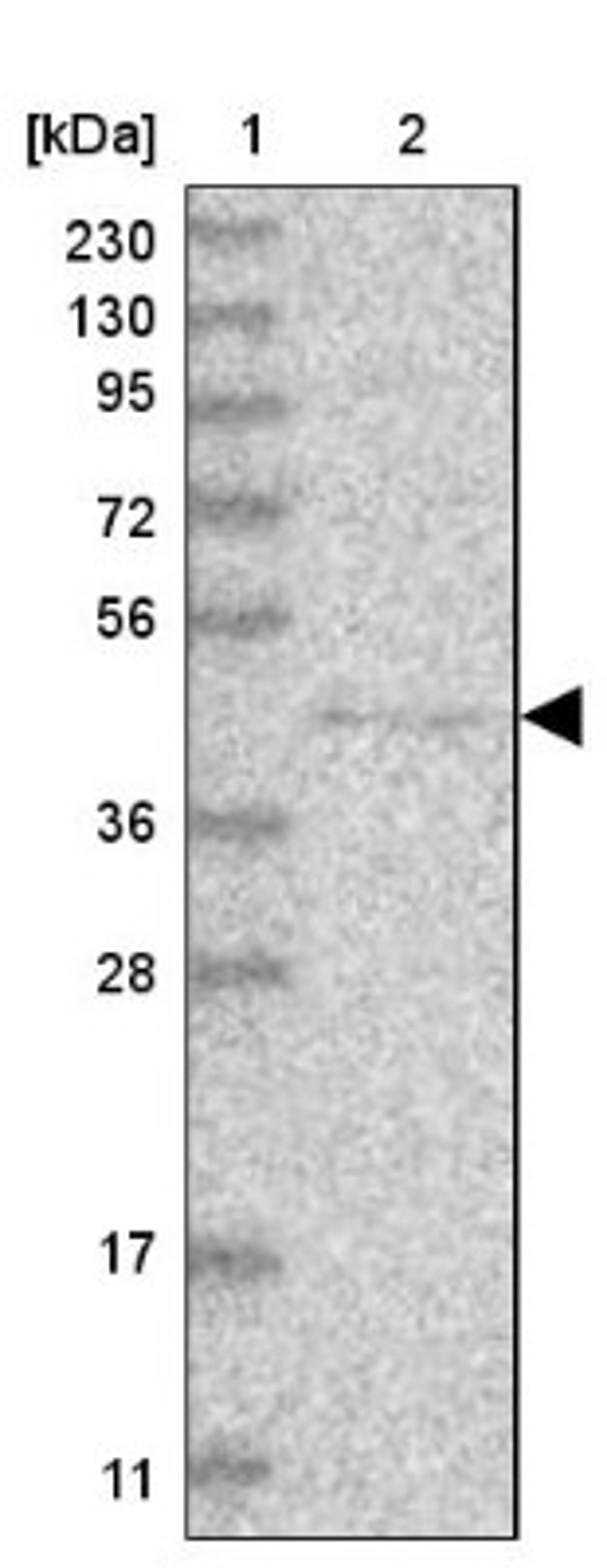 Western Blot: PCMTD1 Antibody [NBP1-83817] - Lane 1: Marker [kDa] 230, 130, 95, 72, 56, 36, 28, 17, 11<br/>Lane 2: Human cell line RT-4