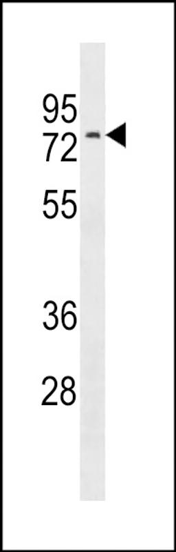 Western blot analysis in CEM cell line lysates (35ug/lane).