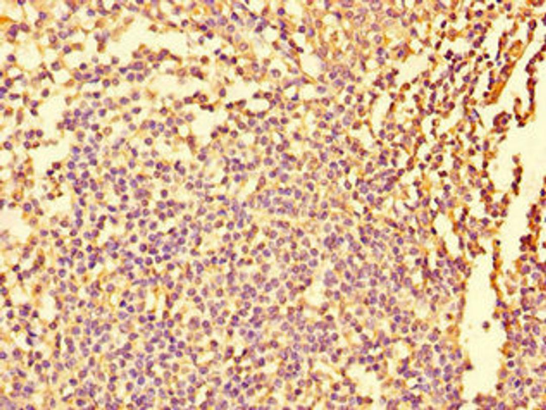 Immunohistochemistry of paraffin-embedded human tonsil tissue using CSB-PA008676LA01HU at dilution of 1:100