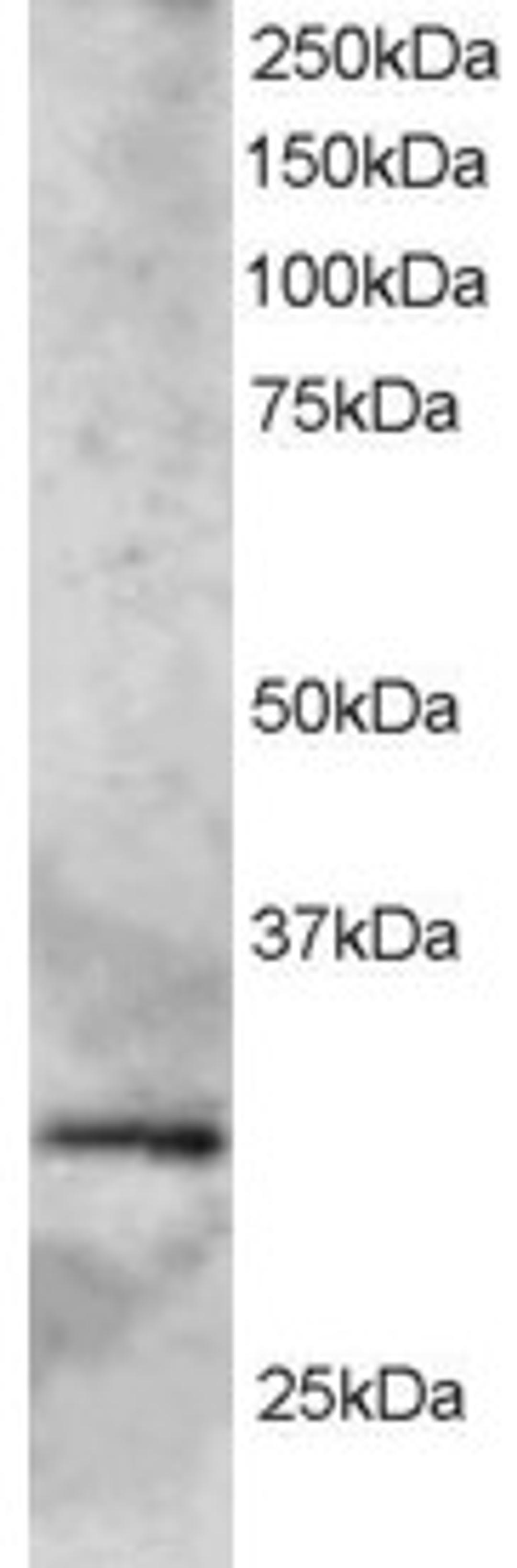 45-661 staining (2ug/ml) of Human Heart lysate (RIPA buffer, 35ug total protein per lane). Primary incubated for 1 hour. Detected by western blot using chemiluminescence.