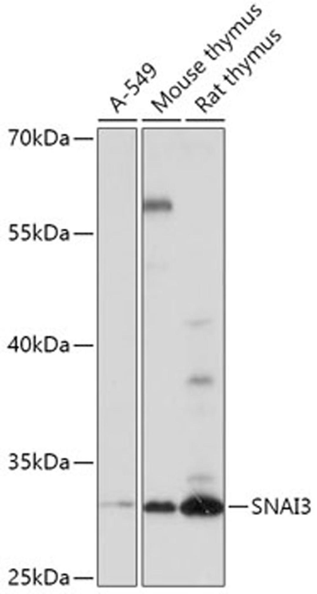 Western blot - SNAI3 antibody (A17854)