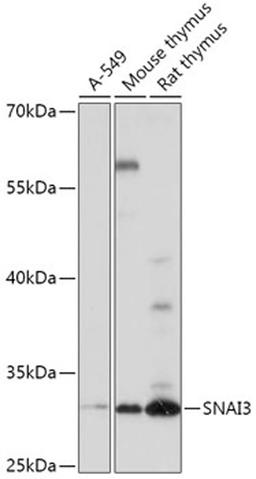 Western blot - SNAI3 antibody (A17854)