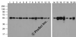 Western blot analysis of Alpha-tubulin in multiple cell and tissue lysates with Biotin-Alpha-tubulin antibody at 1 &#956;g/ml. Lanes 1-20: 293, A431, A549, Daudi, HeLa, HepG2, Jurkat, K562, MOLT, 3T3, Raji, THP-1, U937, human brain, mouse brain, rat brain