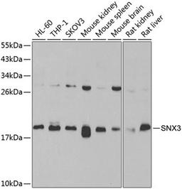 Western blot - SNX3 antibody (A7502)