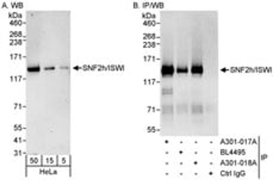 Detection of human SNF2h/ISWI by western blot and immunoprecipitation.